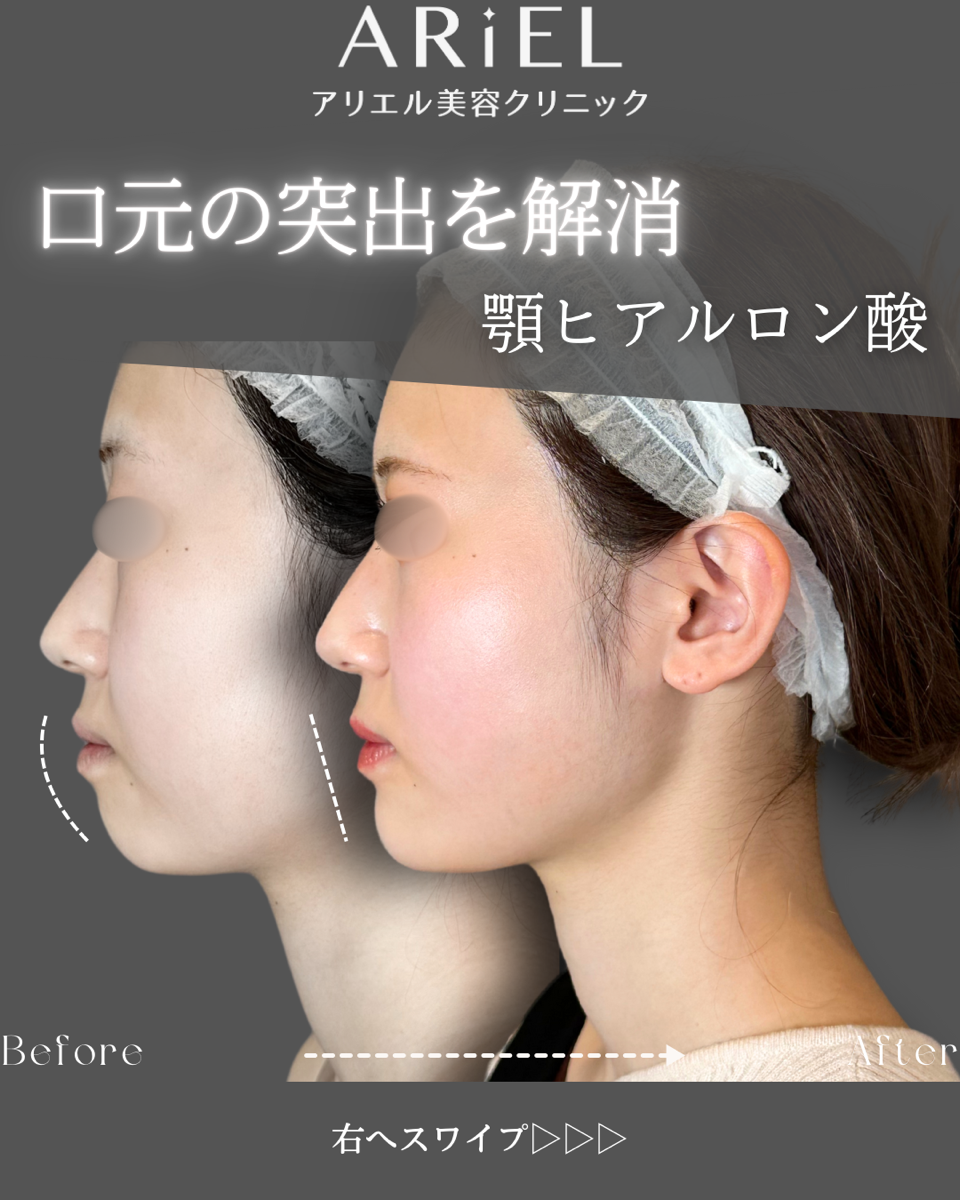 No.8907の症例写真